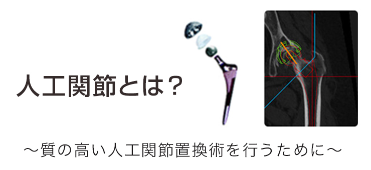 人工関節とは? 〜質の高い人工関節置換術を行うために〜